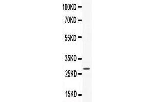 Anti-CNTF Picoband antibody,  All lanes: Anti-CNTF at 0. (CNTF 抗体  (AA 2-200))