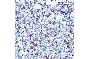 Immunohistochemistry of paraffin-embedded human tonsil using SPN antibody (ABIN2560118) at dilution of 1:100 (40x lens). (CD43 抗体)