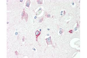 Anti-SRR / Serine Racemase antibody IHC staining of human brain, cortex. (SRR 抗体)