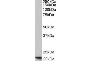 ABIN334401 (1µg/ml) staining of Human Placenta lysate (35µg protein in RIPA buffer). (FTH1 抗体  (C-Term))