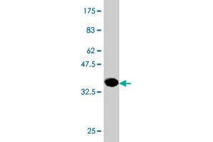 Western Blot detection against Immunogen (36. (PHOSPHO1 抗体  (AA 168-266))
