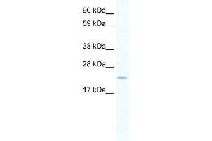 Human Placenta; WB Suggested Anti-SERTAD1 Antibody. (SERTAD1 抗体  (N-Term))