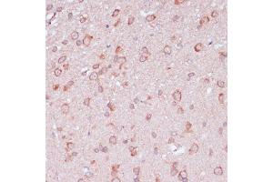 Immunohistochemistry of paraffin-embedded rat brain using RPL32 antibody (ABIN6129104, ABIN6147138, ABIN6147139 and ABIN6216824) at dilution of 1:100 (40x lens). (RPL32 抗体  (AA 1-135))