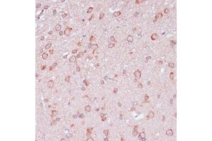 Immunohistochemistry of paraffin-embedded rat brain using RPL32 antibody (ABIN6129104, ABIN6147138, ABIN6147139 and ABIN6216824) at dilution of 1:100 (40x lens). (RPL32 抗体  (AA 1-135))