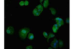 Immunofluorescent analysis of MCF-7 cells using ABIN7156442 at dilution of 1:100 and Alexa Fluor 488-congugated AffiniPure Goat Anti-Rabbit IgG(H+L) (ITGA5 抗体  (AA 220-472))