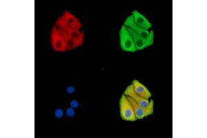 ABIN7096150 and ABIN7100212 staining Hela cells by IF/ICC. (ABRA 抗体)