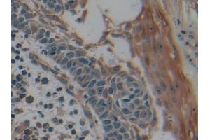 Immunohistochemistry (IHC) image for anti-Keratin 9 (KRT9) (AA 315-456) antibody (ABIN7431980)