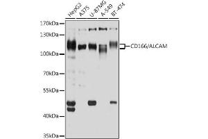 Western blot analysis of extracts of various cell lines, using CD166/CD166/ALCAM antibody (ABIN6127405, ABIN6136759, ABIN6136760 and ABIN6219454) at 1:1000 dilution. (CD166 抗体  (AA 28-180))