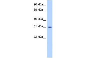 WB Suggested Anti-APOBEC2 Antibody Titration:  1. (APOBEC2 抗体  (N-Term))