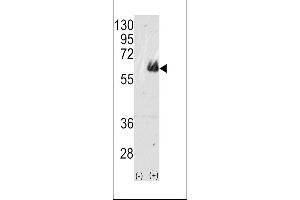 Western blot analysis of TAU(arrow) using rabbit polyclonal TAU Antibody (ABIN388782 and ABIN2839114). (tau 抗体  (C-Term))