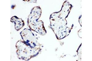 Immunohistochemistry (IHC) image for anti-Hydroxysteroid (17-Beta) Dehydrogenase 1 (HSD17B1) (AA 29-43) antibody (ABIN3031269)