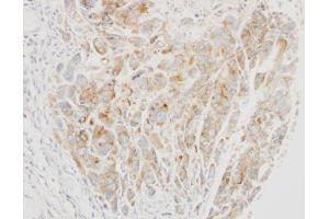 IHC-P Image Immunohistochemical analysis of paraffin-embedded A549 xenograft, using VPS26, antibody at 1:500 dilution. (VPS26A 抗体  (C-Term))