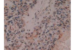 Immunohistochemistry (IHC) image for anti-Proteasome (Prosome, Macropain) 26S Subunit, Non-ATPase, 13 (PSMD13) (AA 1-378) antibody (ABIN7442168)