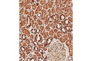 Immunohistochemistry (Paraffin-embedded Sections) (IHC (p)) image for anti-Transient Receptor Potential Cation Channel, Subfamily V, Member 1 (TRPV1) (AA 124-153), (N-Term) antibody (ABIN657909)