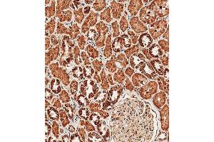 Immunohistochemical analysis of paraffin-embedded human kidney tissue using (ABIN657909 and ABIN2846858) performed on the Leica® BOND RXm. (TRPV1 抗体  (N-Term))