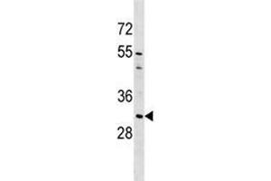AQP1 antibody western blot analysis in A549 lysate (Aquaporin 1 抗体  (AA 241-269))