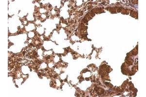 IHC-P Image Cyclophilin E antibody detects Cyclophilin E protein at nucleus and cytosol on mouse lung by immunohistochemical analysis. (PPIE 抗体)
