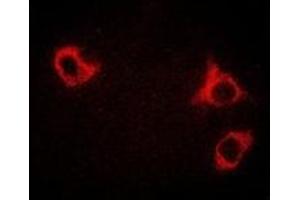 Immunofluorescent analysis of GCN2 staining in HepG2 cells. (GCN2 抗体)