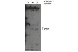Western Blotting (WB) image for anti-KSHV ORF57 antibody (ABIN2995166) (KSHV ORF57 抗体)