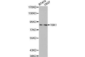 Western blot analysis of extracts of various cell lines, using TBK1 antibody. (TBK1 抗体  (AA 440-729))
