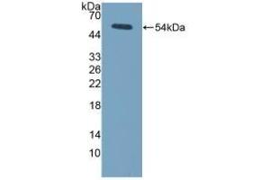 Detection of Recombinant LOX, Mouse using Polyclonal Antibody to Lysyl Oxidase (LOX) (LOX 抗体  (AA 207-411))