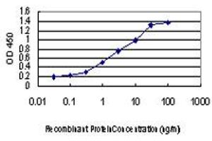 Detection limit for recombinant GST tagged CDKL1 is approximately 0. (CDKL1 抗体  (AA 259-358))