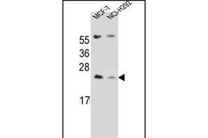 LIN7C Antibody (C-term) (ABIN656734 and ABIN2845958) western blot analysis in MCF-7,NCI- cell line lysates (35 μg/lane). (LIN7C 抗体  (C-Term))