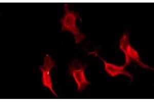 ABIN6274284 staining HepG2 by IF/ICC. (Ephrin A3 抗体  (C-Term))