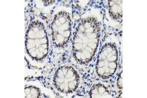 Immunohistochemistry (IHC) image for anti-SATB Homeobox 2 (SATB2) antibody (ABIN7270152)