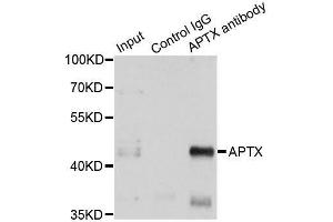 Immunoprecipitation analysis of 150ug extracts of A549 cells using 3ug APTX antibody. (Aprataxin 抗体  (AA 93-342))