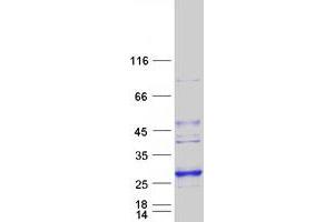 Validation with Western Blot (LYPLAL1 Protein (Myc-DYKDDDDK Tag))