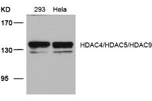 Western blot analysis of extracts from 293 and Hela cells using HDAC4/HDAC5/HDAC9(Ab-246/259/220) Antibody. (HDAC4/HDAC5/HDAC9 抗体)
