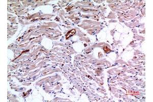 Immunohistochemistry (IHC) analysis of paraffin-embedded Human Heart, antibody was diluted at 1:100. (IDH3A 抗体  (Internal Region))