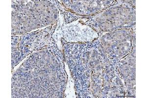 IHC analysis of TP53I13 using anti-TP53I13 antibody (ABIN7601220). (TP53I13 抗体  (AA 30-365))