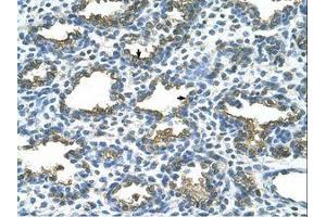 Image no. 1 for anti-Placental Alkaline Phosphatase (ALPP) (AA 411-460) antibody (ABIN203490) (PLAP 抗体  (AA 411-460))