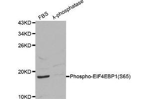 Western blot analysis on 293 cell lysates using Phospho-EIF4EBP1-S65 antibody. (eIF4EBP1 抗体  (pSer65))