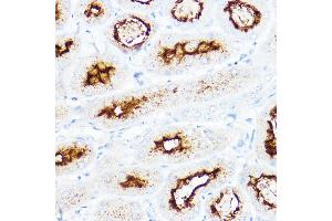 Immunohistochemistry of paraffin-embedded mouse kidney using SLC3 Rabbit pAb (ABIN6132663, ABIN6147998, ABIN6147999 and ABIN6221169) at dilution of 1:200 (40x lens). (SLC3A1 抗体  (AA 416-685))