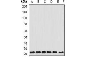 Western blot analysis of Transgelin-2 expression in HEK293T (A), Hela (B), THP1 (C), MCF7 (D), SKOV3 (E), mouse lung (F) whole cell lysates. (TAGLN2 抗体)