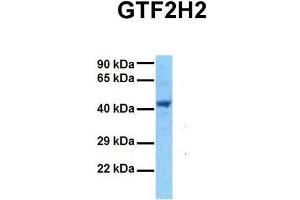 Host:  Rabbit  Target Name:  GTF2H2  Sample Tissue:  Human 293T  Antibody Dilution:  1. (GTF2H2 抗体  (Middle Region))
