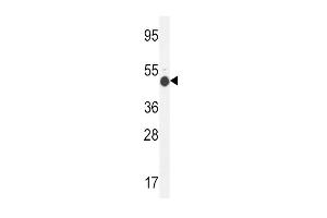 Western blot analysis in mouse kidney tissue lysates (35ug/lane). (GCNT2 抗体  (C-Term))