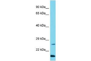 Host: Rabbit Target Name: C10orf95 Sample Type: Jurkat Whole Cell lysates Antibody Dilution: 1. (C10ORF95 抗体  (N-Term))