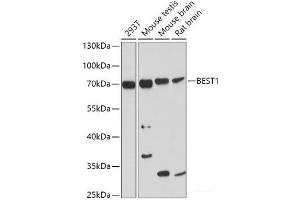 Western blot analysis of extracts of various cell lines using BEST1 Polyclonal Antibody at dilution of 1:1000. (Bestrophin 1 抗体)