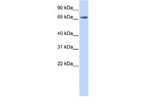 DLG3 antibody used at 1 ug/ml to detect target protein. (DLG3 抗体)