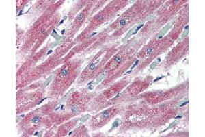 anti-Pleckstrin Homology Domain Containing, Family H (With MyTH4 Domain) Member 2 (PLEKHH2) (C-Term) antibody