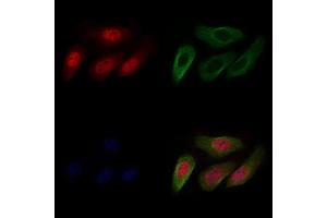 ABIN6265350 and ABIN6266871 staining Hela cells by IF/ICC.