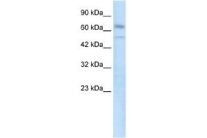 WB Suggested Anti-ZNF306 Antibody Titration:  0. (ZKSCAN3 抗体  (N-Term))