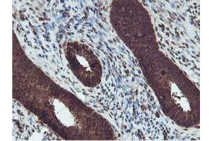Immunohistochemical staining of paraffin-embedded Human endometrium tissue using anti-RUVBL2 mouse monoclonal antibody. (RUVBL2 抗体  (AA 113-370))