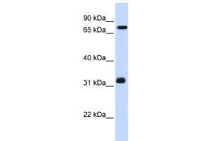 TCP10 antibody used at 1 ug/ml to detect target protein. (TCP10 抗体)