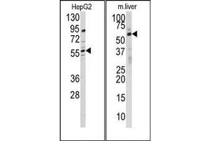 Image no. 1 for anti-24-Dehydrocholesterol Reductase (DHCR24) (N-Term) antibody (ABIN358014) (Seladin 1 抗体  (N-Term))