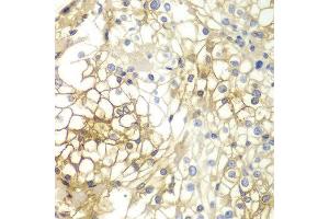 Immunohistochemistry (IHC) image for anti-Syndecan 1 (SDC1) (AA 25-240) antibody (ABIN3021805) (Syndecan 1 抗体  (AA 25-240))